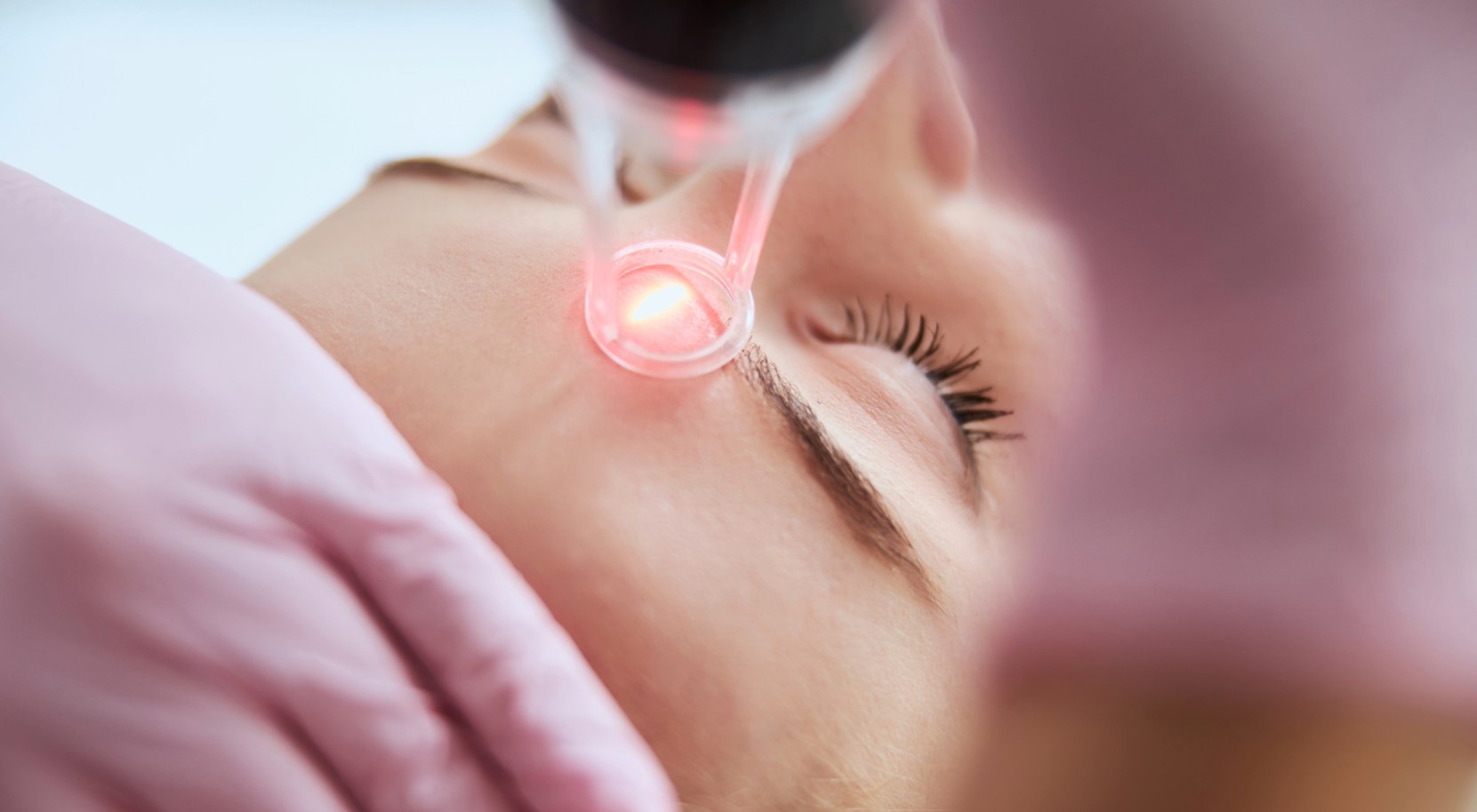 Laser Facial Resurfacing ukraine