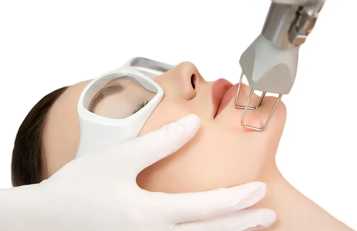 Laser Treatment for Skin: A Modern Approach to Better Skin Care